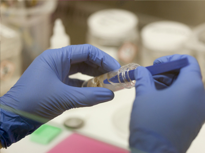 Scientist studying brain tumour in test tube